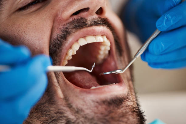 Best Emergency Dentist for Knocked-Out Tooth in North Riverside, IL